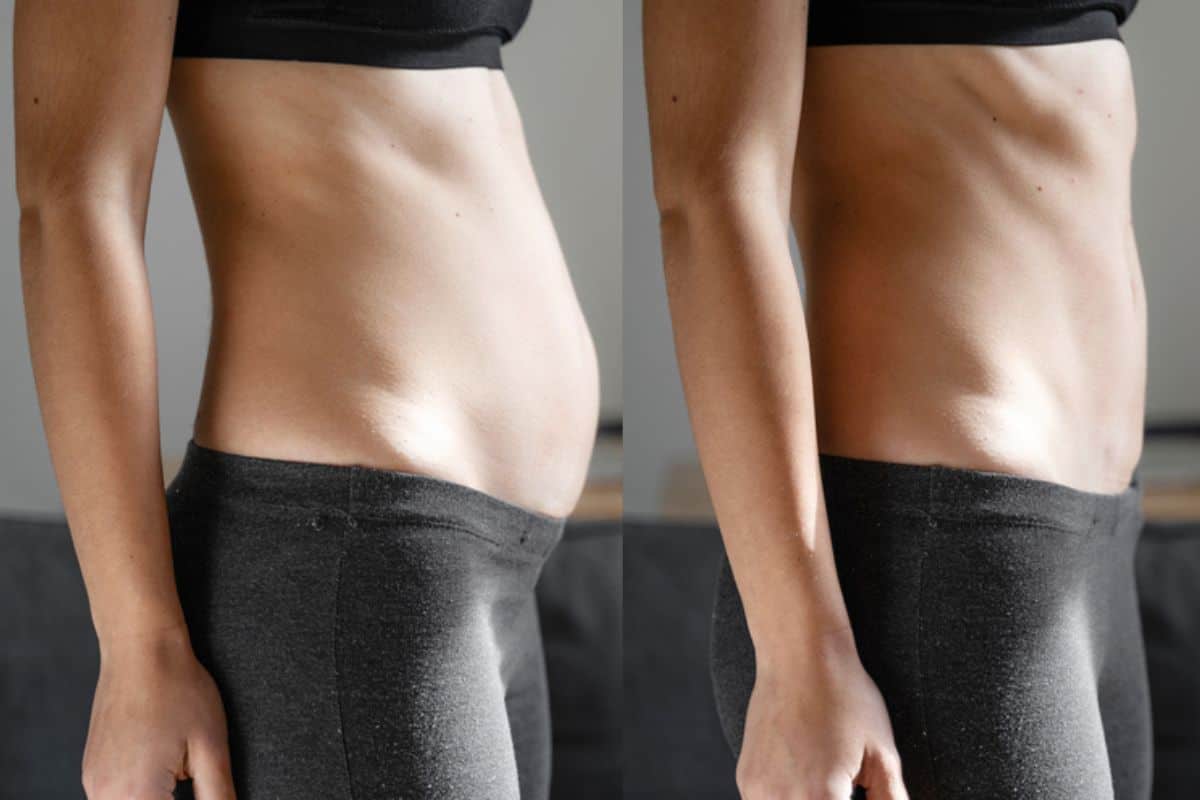 Post-Pregnancy: What Happens to Your Abdominal Muscles After Birth Bristol