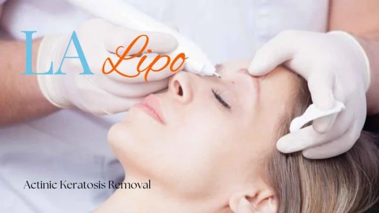 Woman receiving Actinic Keratosis Removal Treatment Bristol