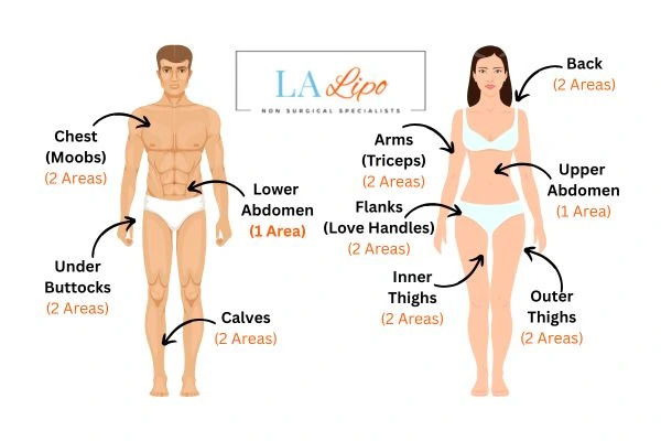 LA LIPO Cryolipolysis Areas Bristol