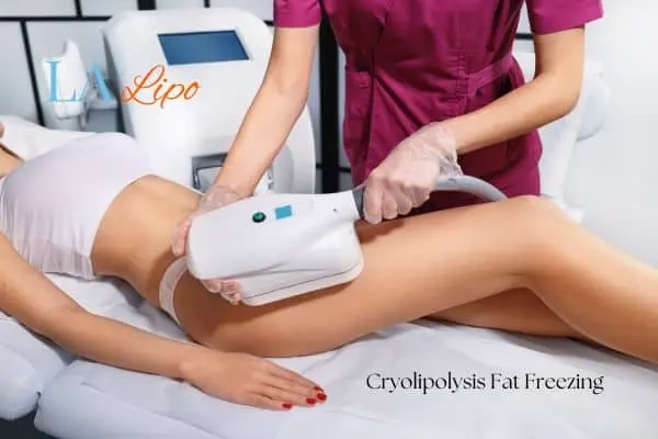 Woman receiving coolsculpting Bristol treatment on her thighs