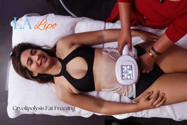 woman getting cryolipolysis Bristol
