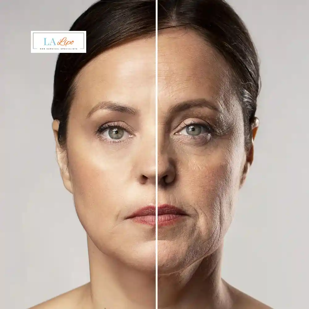 How Can You Tell If Non-Surgical Skin Tightening Is Right for You Bristol?