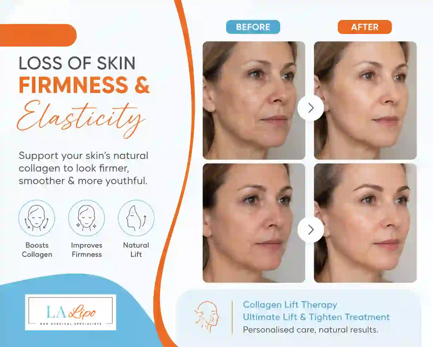 Sign #7: Loss of Skin Firmness and Elasticity Bristol